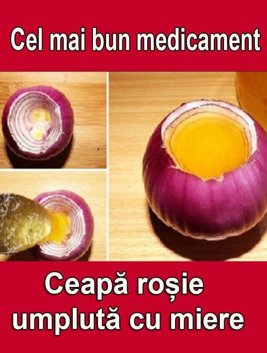 Ceapa rosie umpluta cu miere – Cel mai bun remediu pentru tusea seaca, decongestionarea cailor nazale si scaderea febrei
