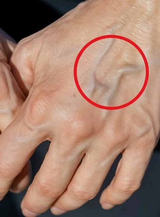 „Dacă ai vene vizibile, înseamnă că ești…”