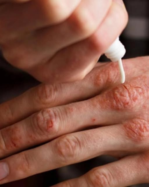 Acestea sunt primele SEMNE ale unei boli