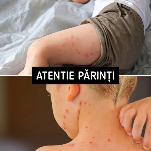 ATENȚIE! Acesta este primul simptom al… Vezi mai multe!