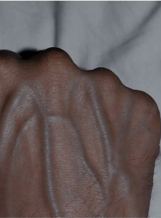 „Dacă venele sunt vizibile pe mâna ta, este un semnal de…