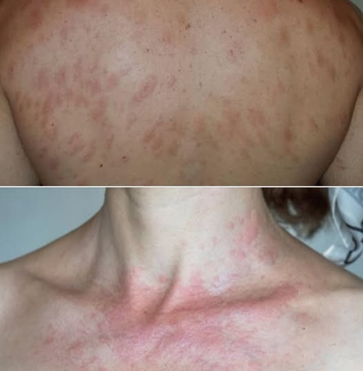 Acestea sunt primele semne ale unei boli… Vezi mai mult