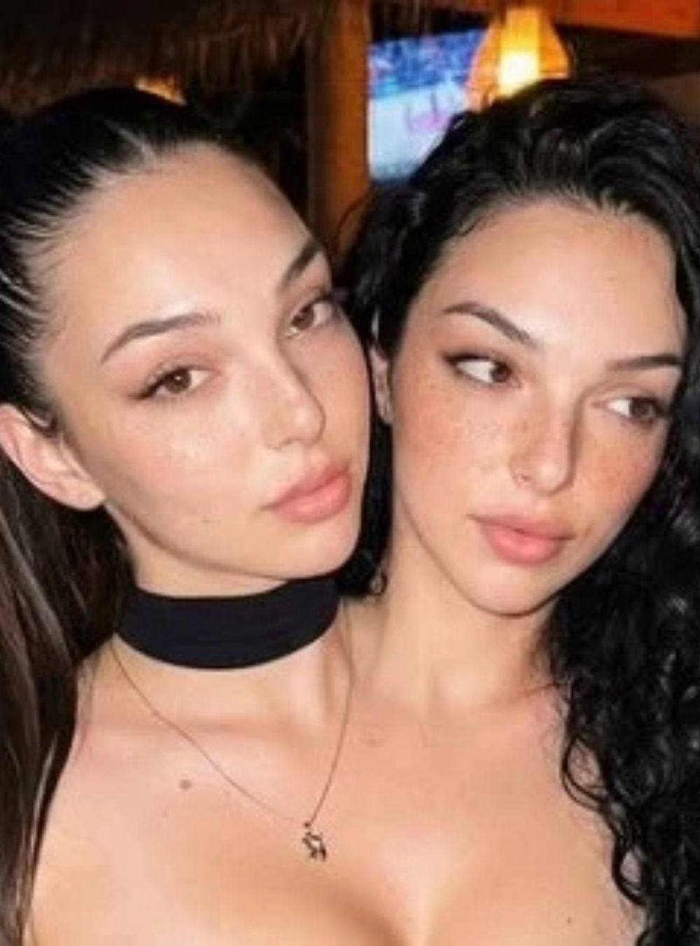 Reale sau nu? Valeria și Camelia, „gemenele siameze” care au înnebunit internetul. Ce se ascunde în spatele imaginilor virale