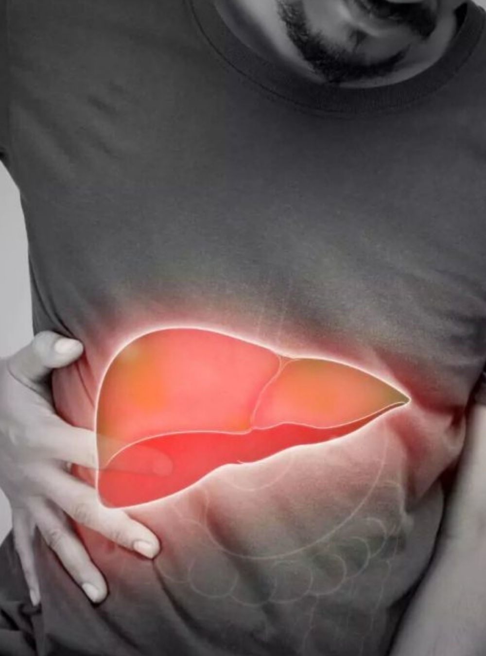 10 semne timpurii ale cirozei hepatice