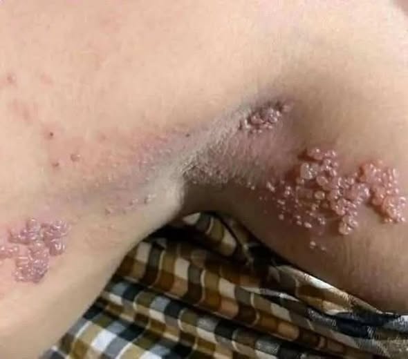 Acestea sunt consecințele somnului cu