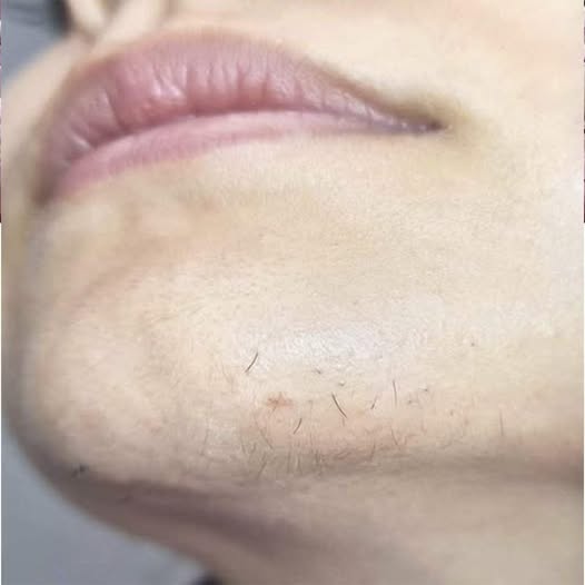 Dacă ești FEMEIE, iată semnele care indică că se dezvoltă