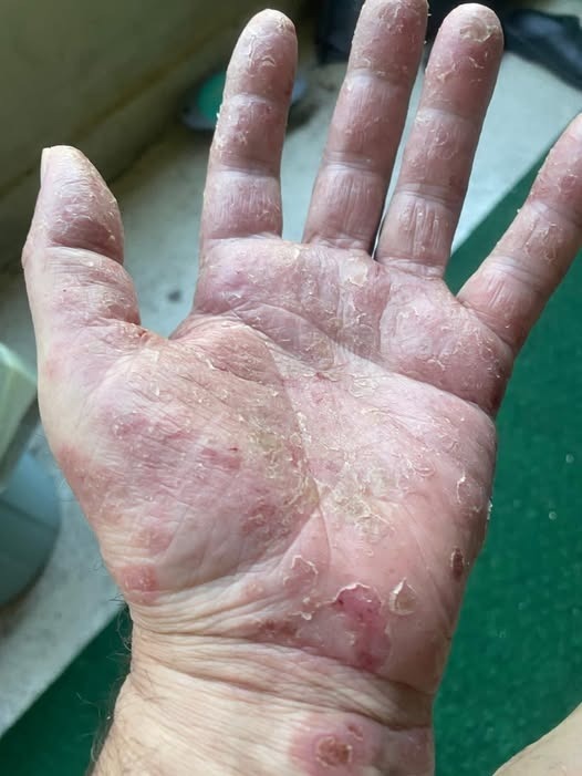 Acestea sunt semnele că se dezvoltă