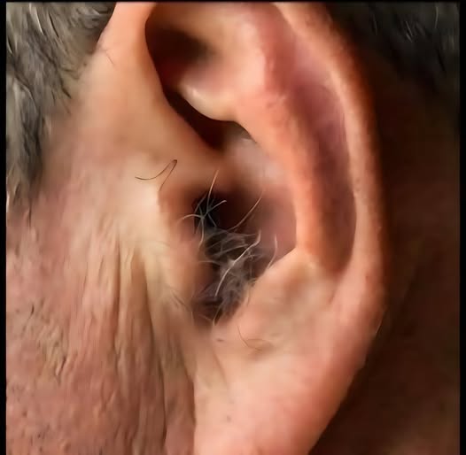 ȘTIAI? Dacă îți cresc fire de păr în urechi, înseamnă că organismul tău