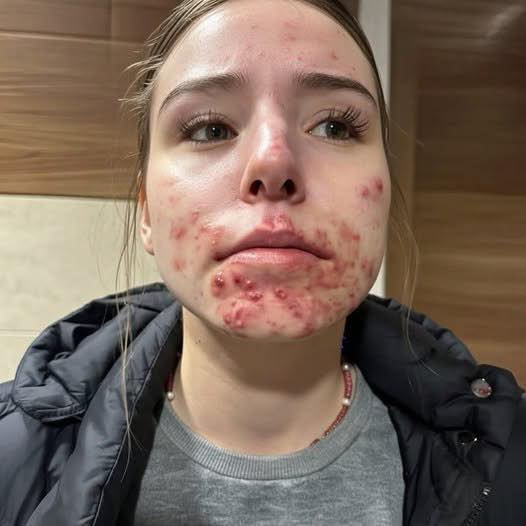 Acestea sunt consecințele la care te expui atunci când dormi cu o…