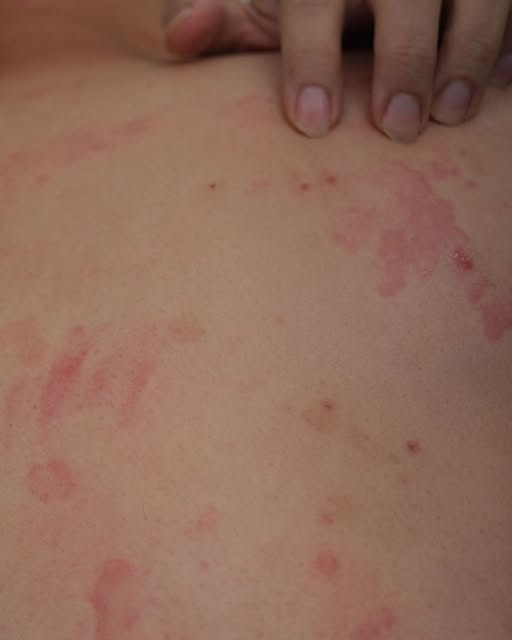 Medicii atrag atenția asupra acestor semne! Primul simptom este… Vezi mai mult