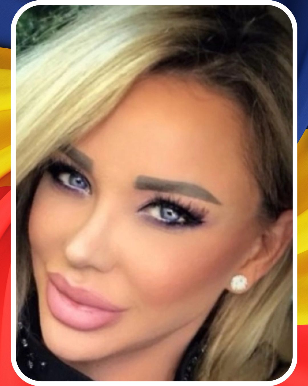 Bianca Drăgușanu s-a operat din nou: Am făcut-o și pe asta. Andreea Raicu a izbucnit în paralel: Toate